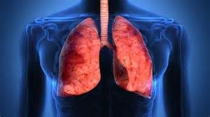 salute-e-benessere-polmoni-ammalati